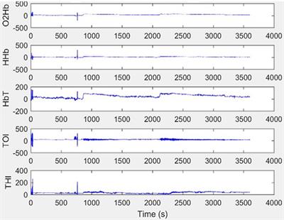 The effect of haemoglobin and blood transfusion on preterm infant gut perfusion and injury